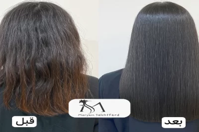 احیای مو با پلکس